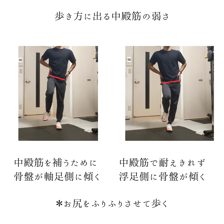 歩き方に現れる中殿筋の弱体化